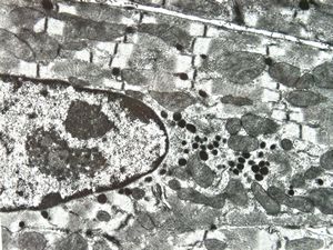 mouse heart atrium … granules of the natriuretic peptide